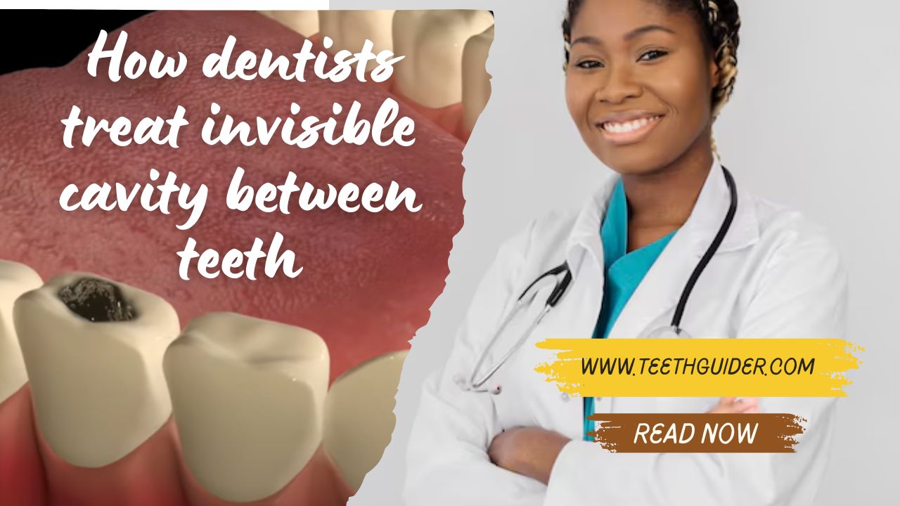 How dentists treat invisible cavity between teeth